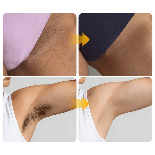 Daugiafunkcis plaukų šalinimo kremas