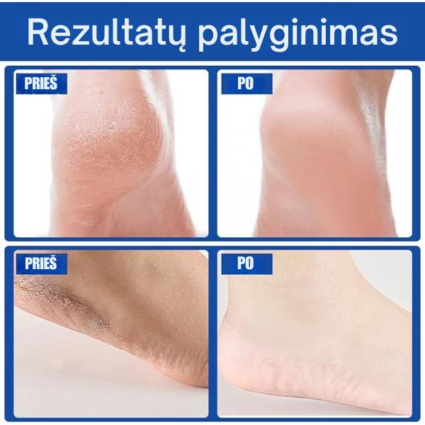Drėkinantis ir apsaugantis kojų kremas