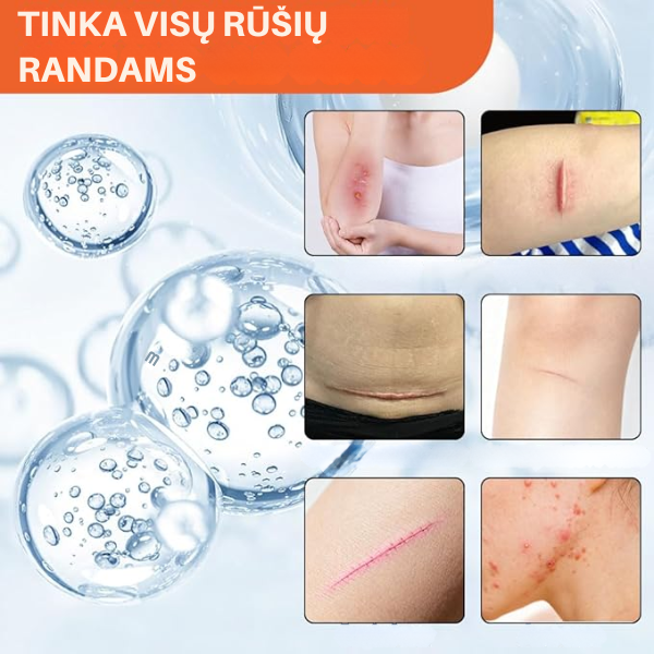 Efektyvi ir veiksminga priemonė randams šalinti