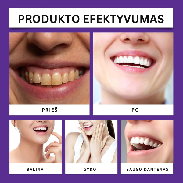 Efektyvi ir veiksminga priemonė dantų balinimui bei gydymui