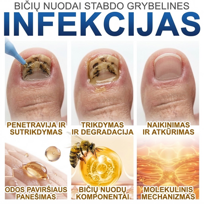Pažangus priešgrybelinis nagų serumas