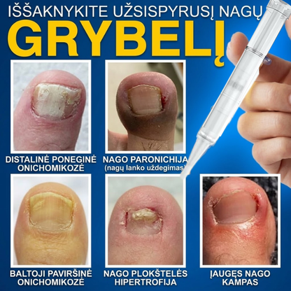 Pažangus priešgrybelinis nagų serumas