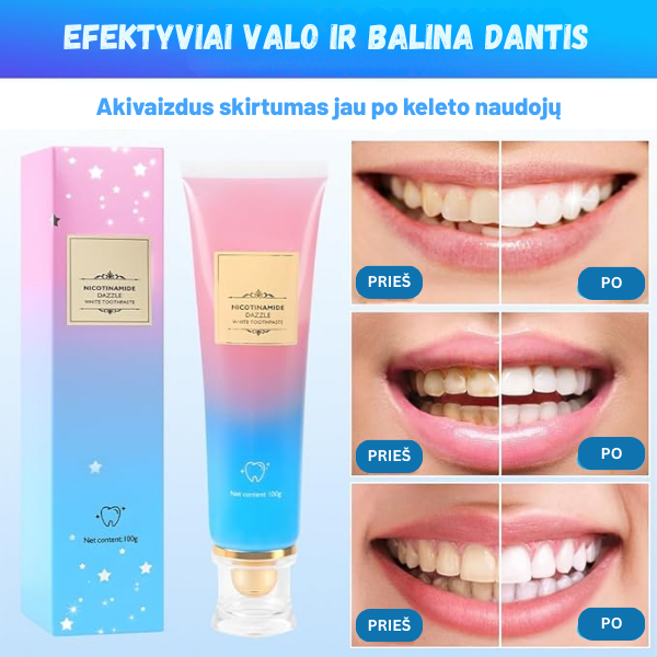 Efektyvi ir itin veiksminga priemonė dantų balinimui bei burnos higienai
