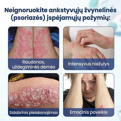 Purškalas nuo niežulio ir pleiskanojimo
