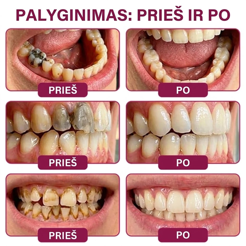 Pažangi dantų remonto, balinimo ir higienos priemonė