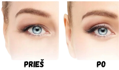 Akių vokų koregavimo juostelės