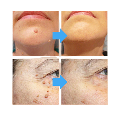 Efektyvi ir veiksminga priemonė odai