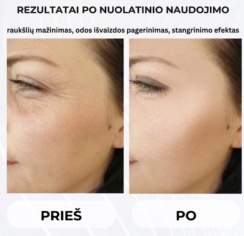 Veido bei kaklo masažuoklis odos stangrinimui ir pakėlimui