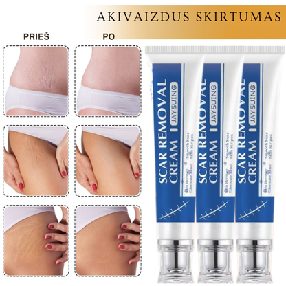 Odos netobulumus šalinantis kremas