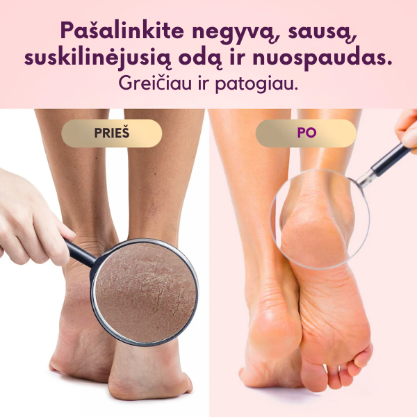 Profesionalus negyvos odos šalinimo prietaisas