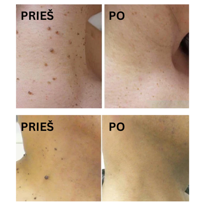 Efektyvi ir veiksminga priemonė odai